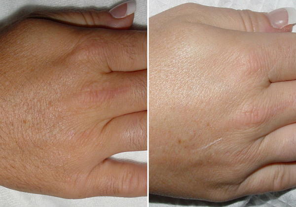 Hands & Fingers