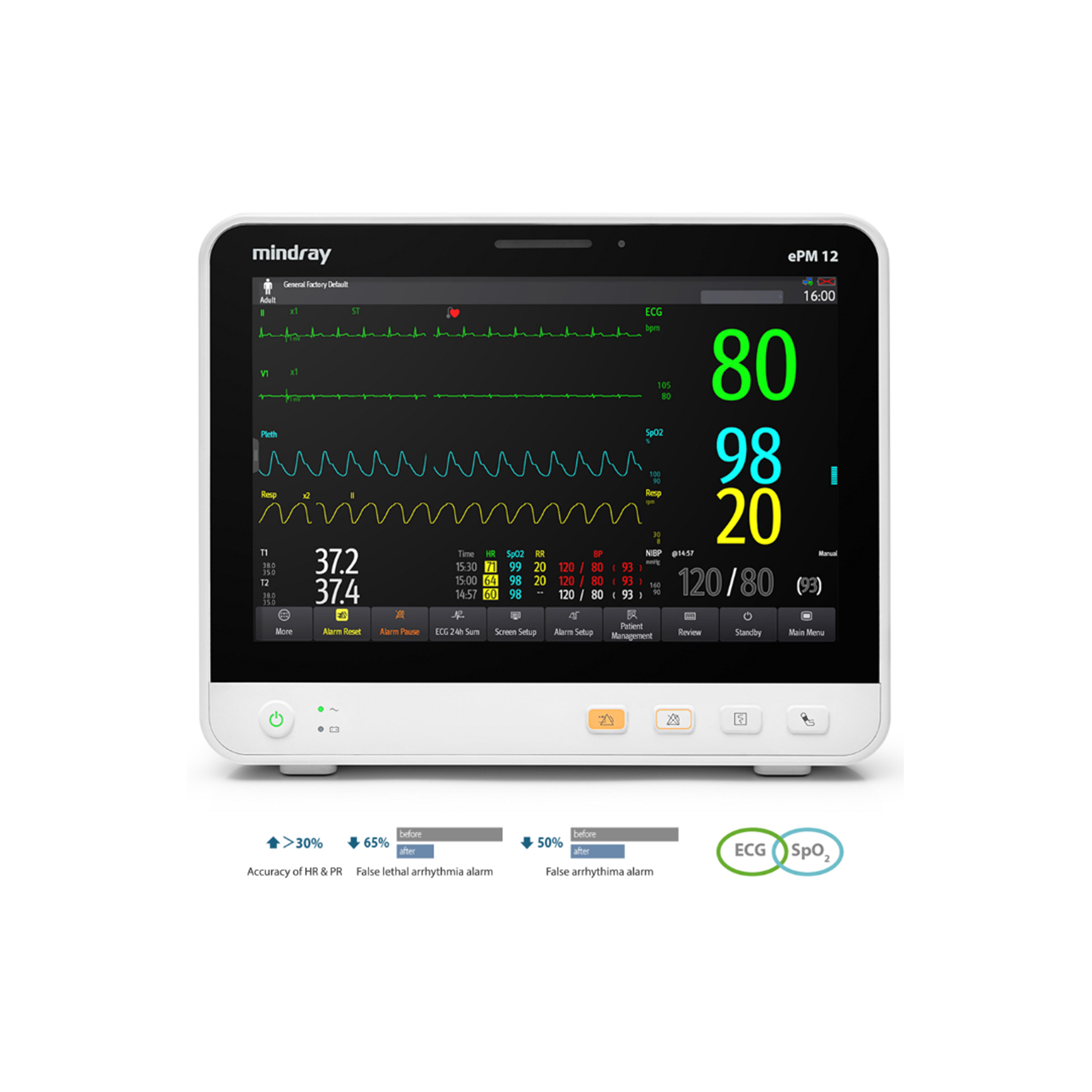 Монітор пацієнта Mindray ePM12M