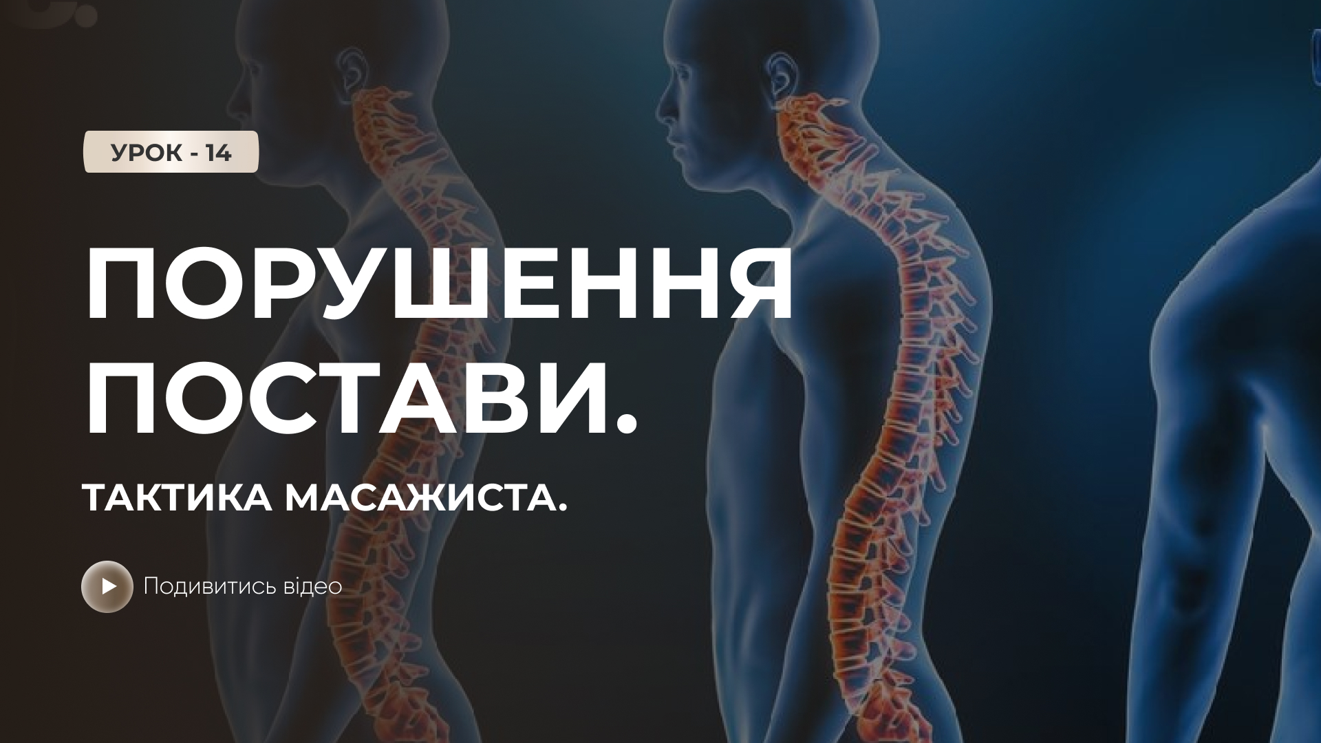 Онлайн-урок: Порушення постави. Тактика масажиста.