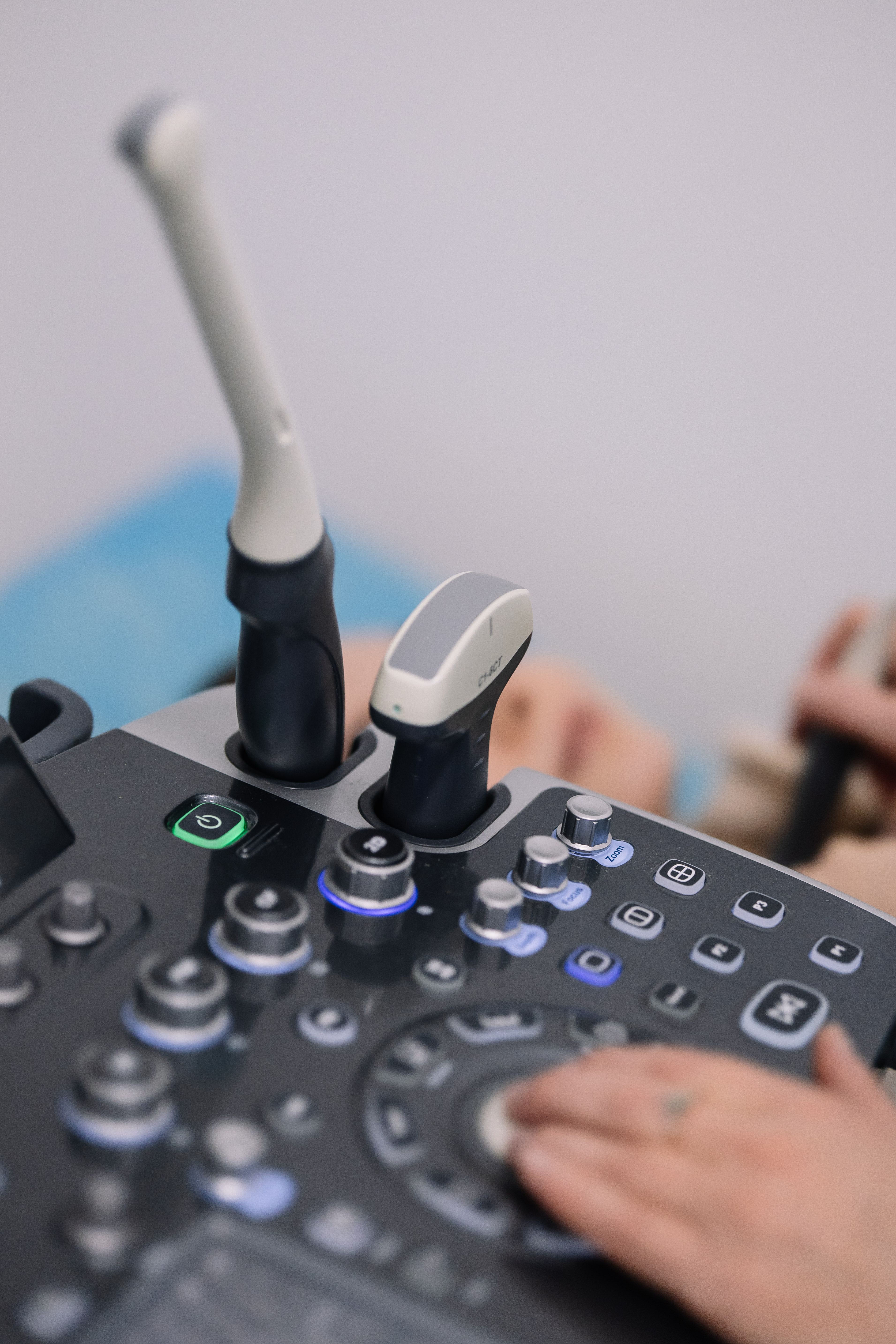 УЗД з приводу вагітності