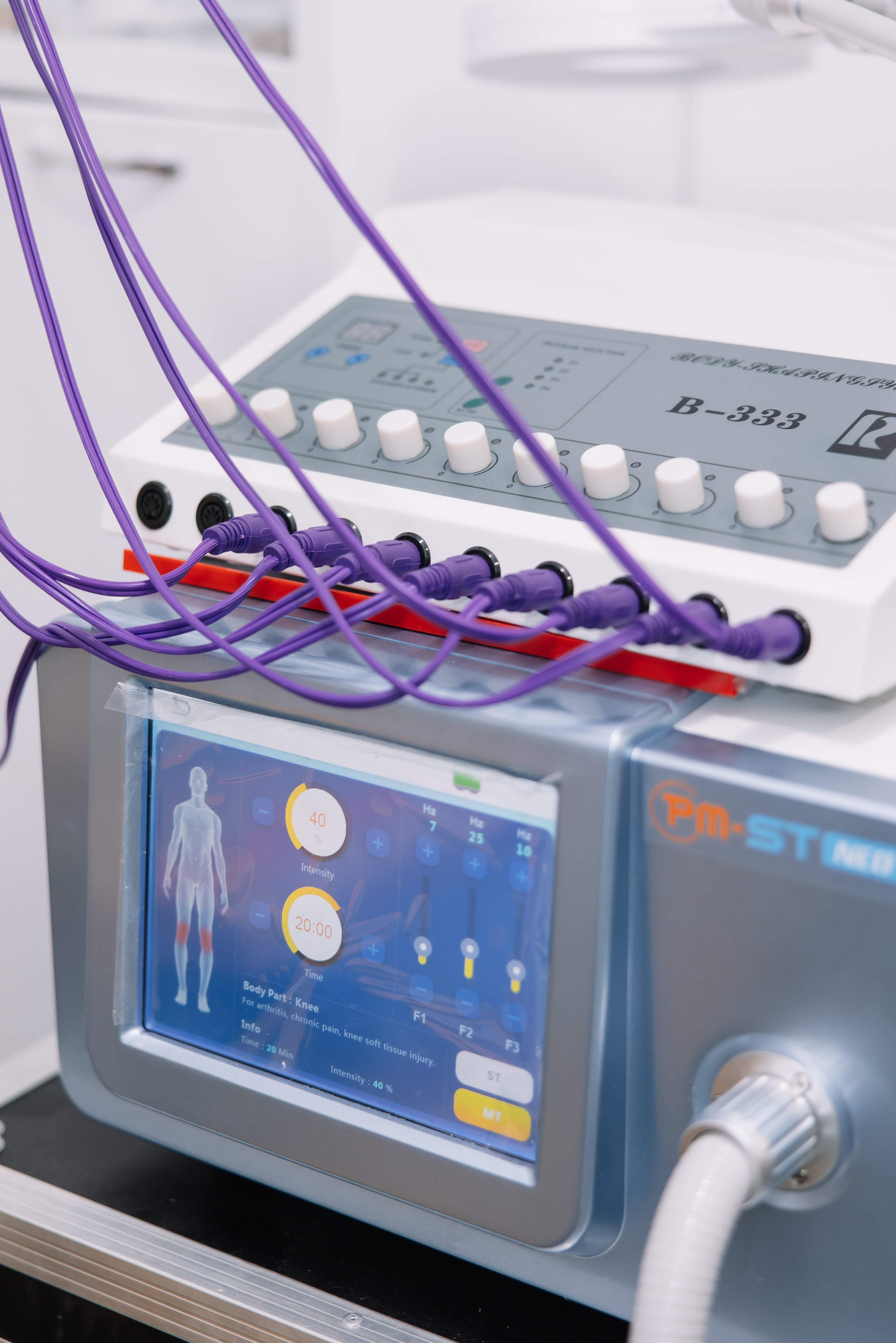 Електроміостимуляція