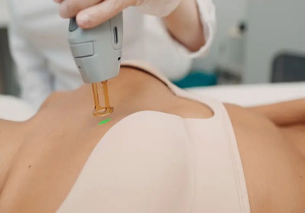 Areolas