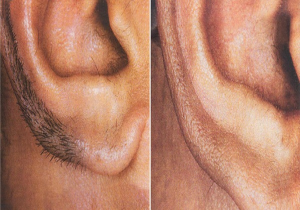 Ear